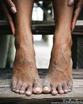 thefeetguide Photos