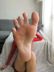sunnyxx Photos
