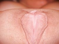 Vagina Perfection