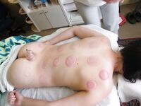 Czech Massage And Treatment Course