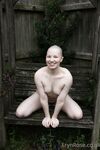 Erynrose