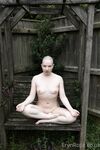 Erynrose