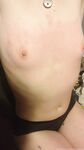 Erynrose
