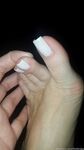 Feetbraga