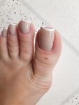 Feetbraga