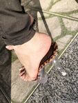 Feetbraga