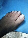 Feetbraga