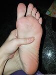 Feetbraga
