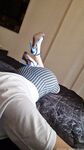 Feetbraga