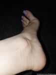 Feetbraga