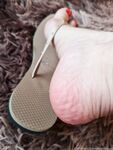Feetbraga