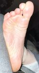 Solewhoe