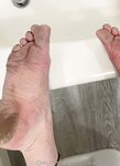 Solewhoe