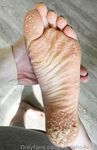 Solewhoe