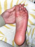 Solewhoe