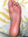 Solewhoe